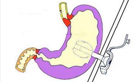 Image de la page couverture